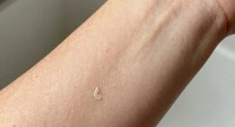 assess skin hydration levels