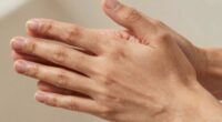 skin contact influences heat retention