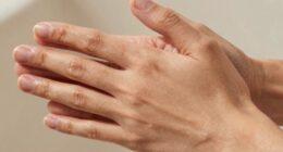 skin contact influences heat retention