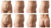 varied lumbar body sensations
