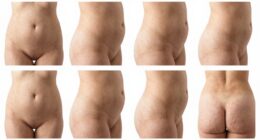 varied lumbar body sensations